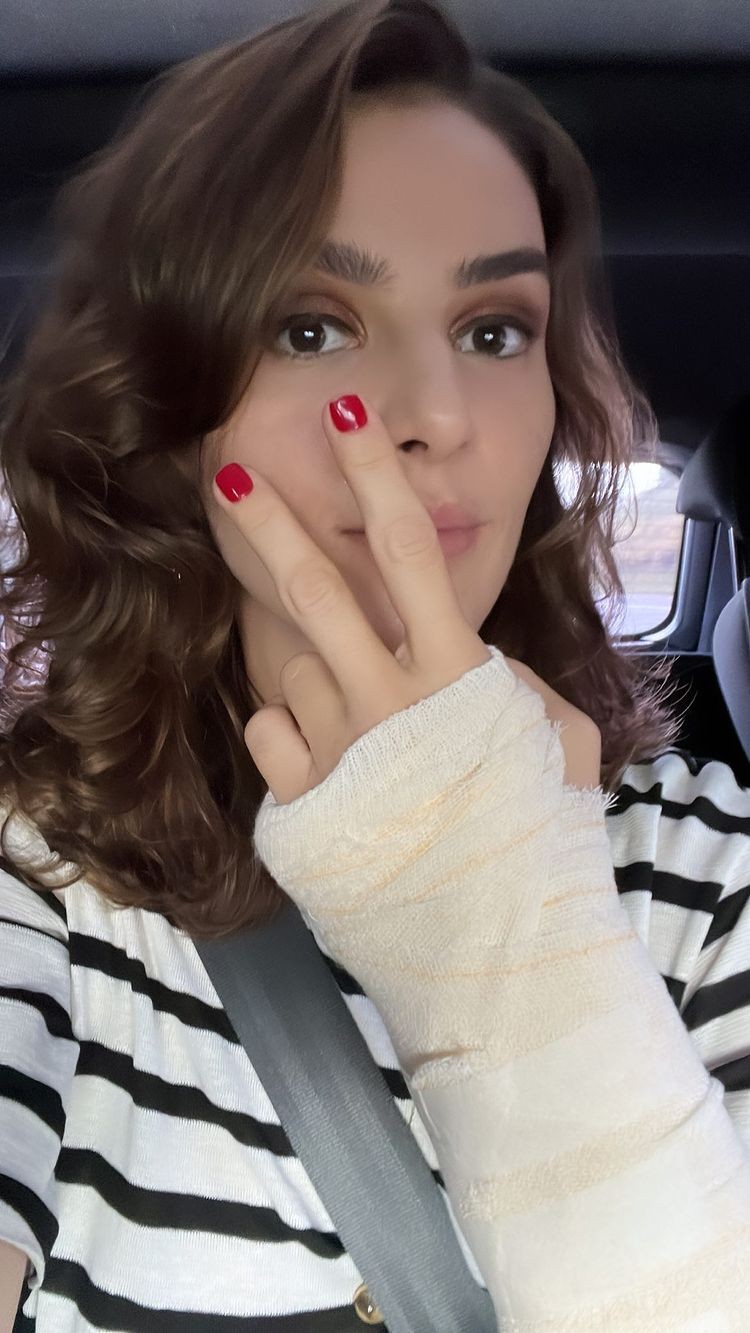 Monica Benini se machuca em acidente doméstico: 'Presente do final de semana' (Foto: reprodução/instagram)