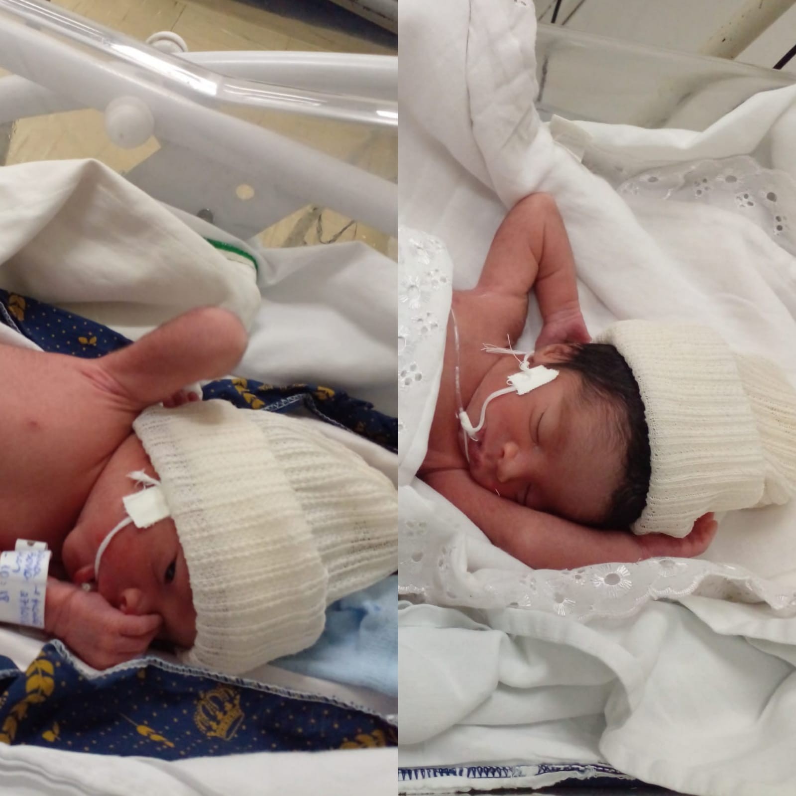 Mãe descobre que estava grávida de gêmeos durante o parto em Cuiabá: 'Todos os exames indicavam feto único'