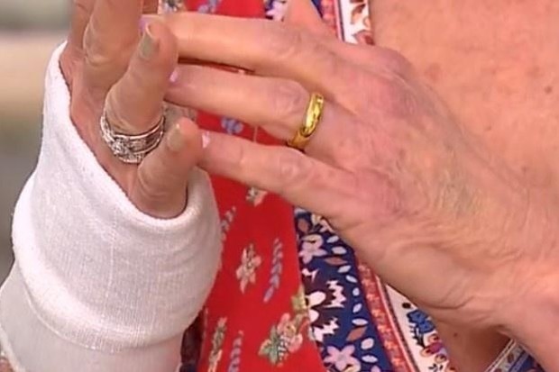 Ana Maria Braga usa proteção de gesso na mão direita (Foto: Reprodução/TV Globo)