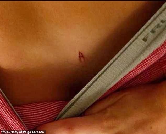 Paige, ex de Armie Hammer, mostra marca feita em seu corpo com faca durante ato sexual (Foto: Reprodução/Instagram)
