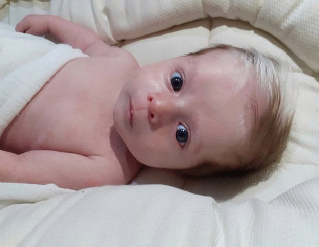 Caçula, que tem apenas 1 mês de vida, também nasceu com  a condição (Foto: Arquivo pessoal)