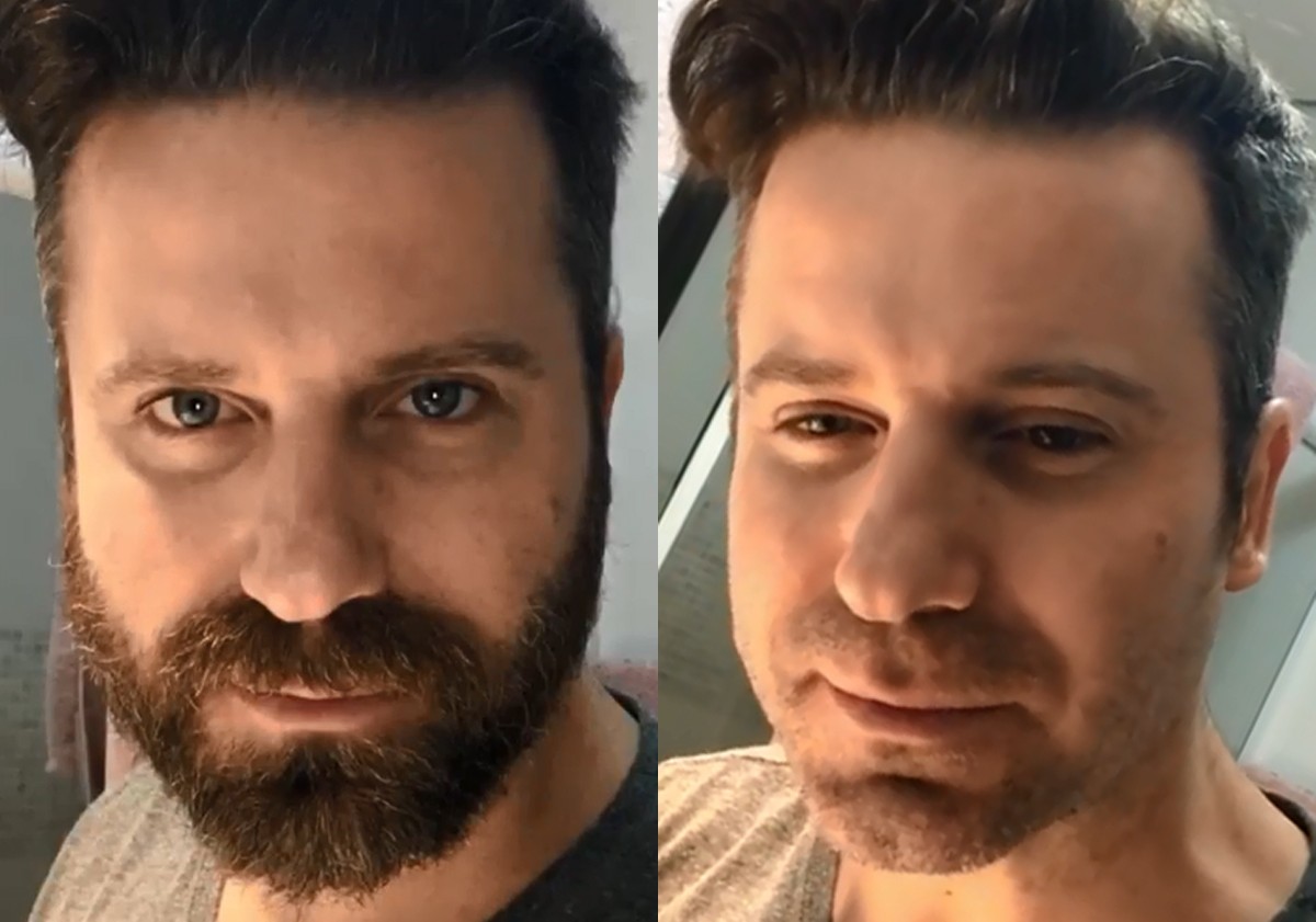 Sertanejo Marlon raspa a barba pela primeira vez depois de 15 anos (Foto: Reprodução/Instagram)