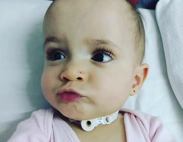 A pequena Allana nasceu com apenas 400 gramas e precisa de 9 cirurgias para retirar a traqueostomia (Foto: Arquivo pessoal)
