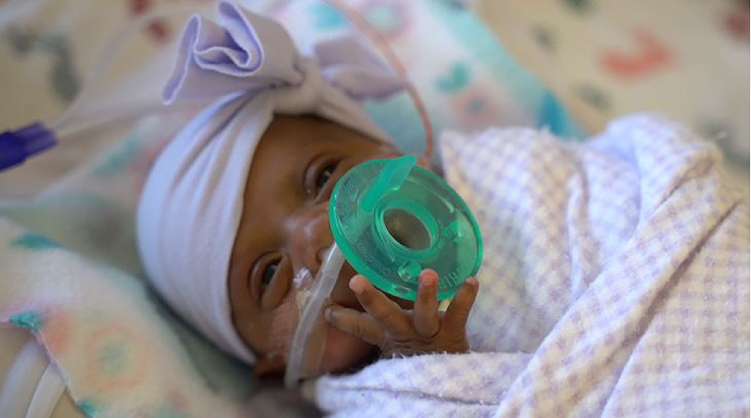 Menor Bebe Do Mundo Completa 5 Meses De Vida Nos Estados Unidos Revista Galileu Ciencia