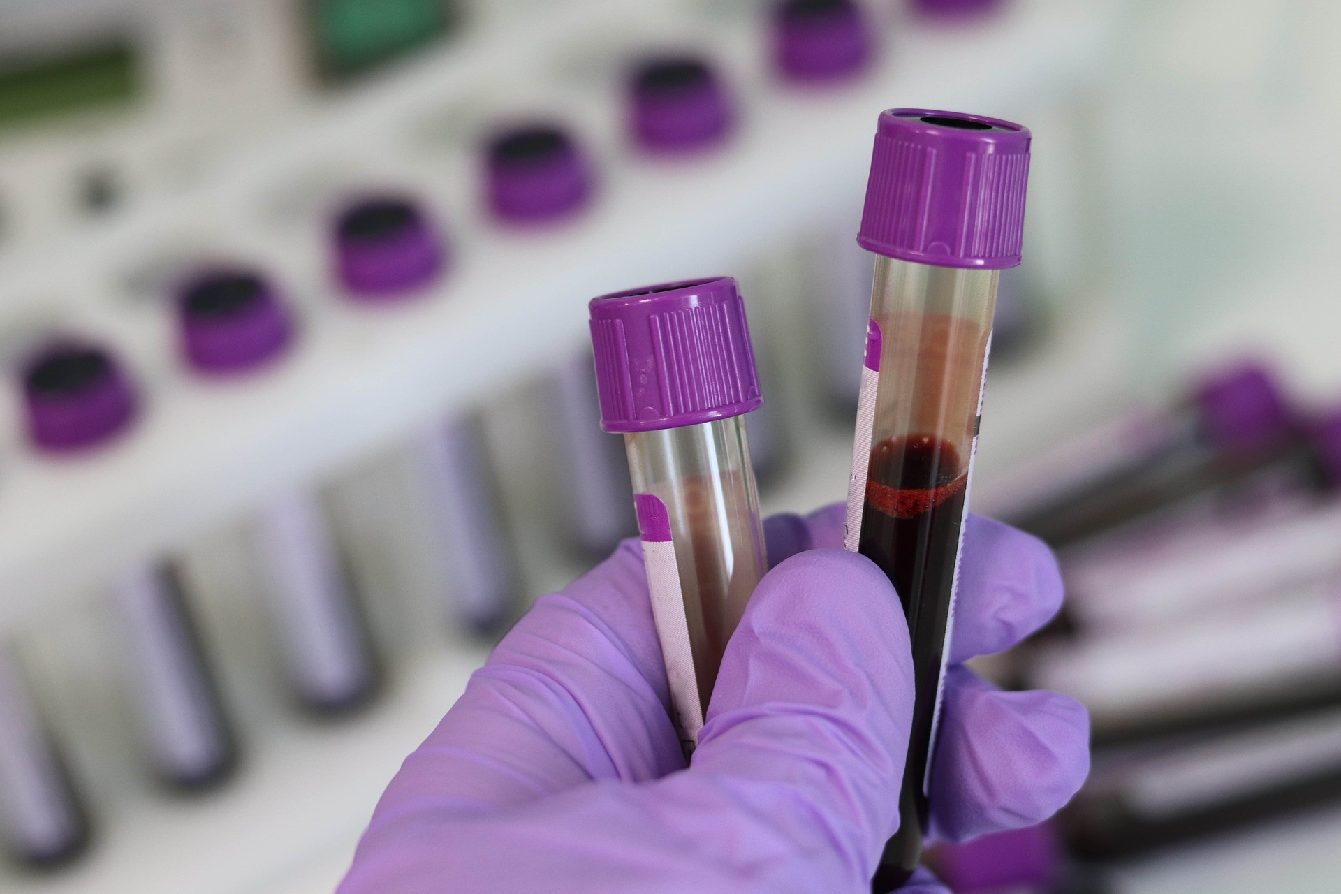 Ainda é um mistério para a ciência o verdadeiro motivo por que temos diferentes tipos sanguíneos (Foto: Pixabay)