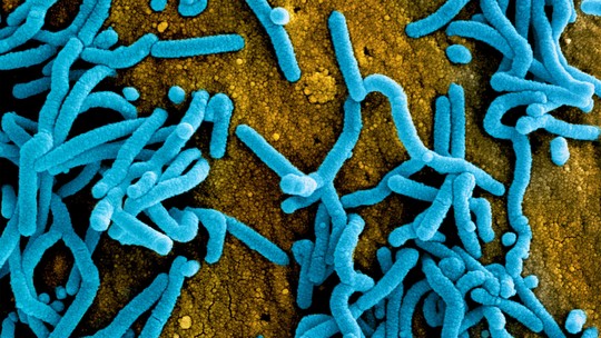 Marburg: vírus da família do ebola é confirmado em surto que já matou nove na Guiné Equatorial