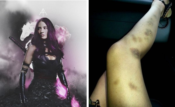 Os machucados da atriz Olivia Munn nas gravações de 'X-Men: Apocalipse' (Foto: Instagram)
