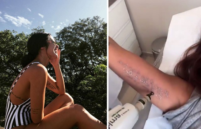 Yanna Lavigne apaga tatuagem no braço (Foto: Reprodução/Instagram)