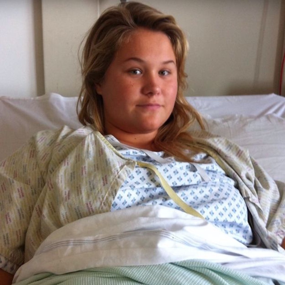 Aos 20 anos, Jasmine passou pela ileostomia   (Foto: Jasmine Stacey/BBC)