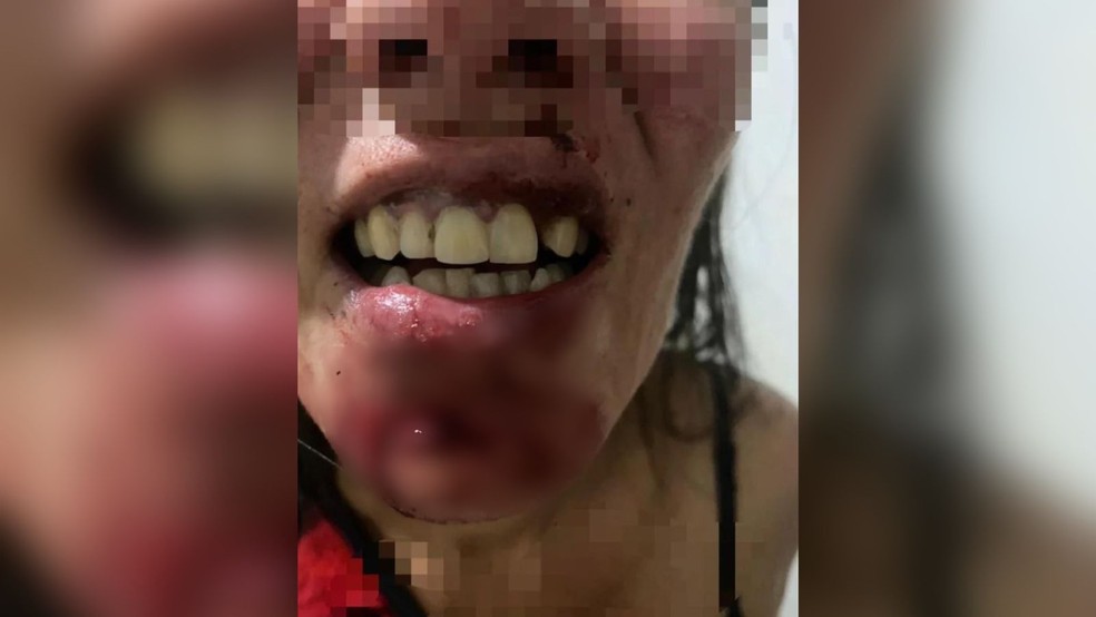 Homem é preso suspeito de agredir a ex com mordida e marteladas — Foto: Reprodução/TV Anhanguera