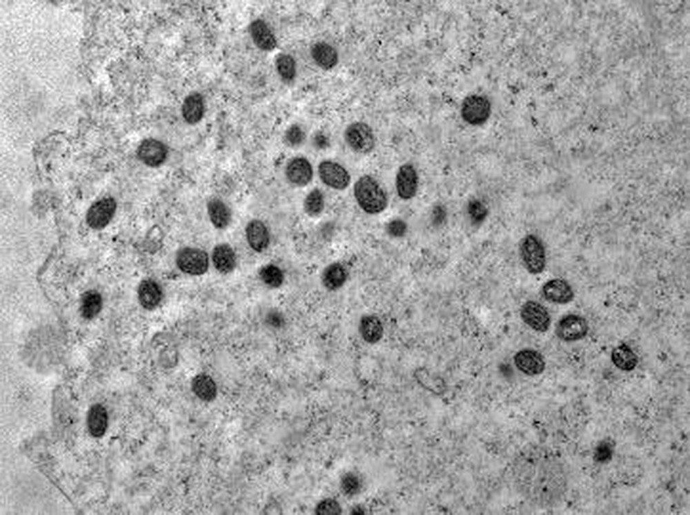 Instituto Oswaldo Cruz isola o vírus monkeypox e registra em imagens sua estrutura detalhada — Foto: Débora F. Barreto-Vieira/IOC/Fiocruz