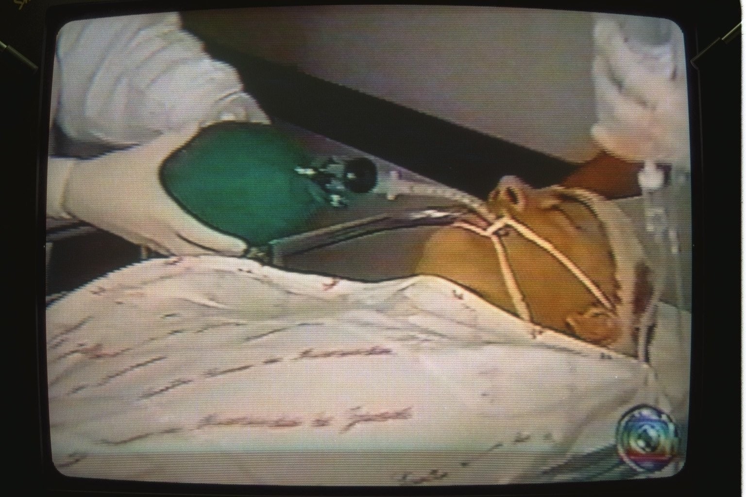 Ate Hoje Os Medicos Se Surpreendem Diz Mulher De Gerson Brenner 20 Anos Apos Ator Ser Baleado Na Cabeca Em Assalto Blog Do Acervo O Globo