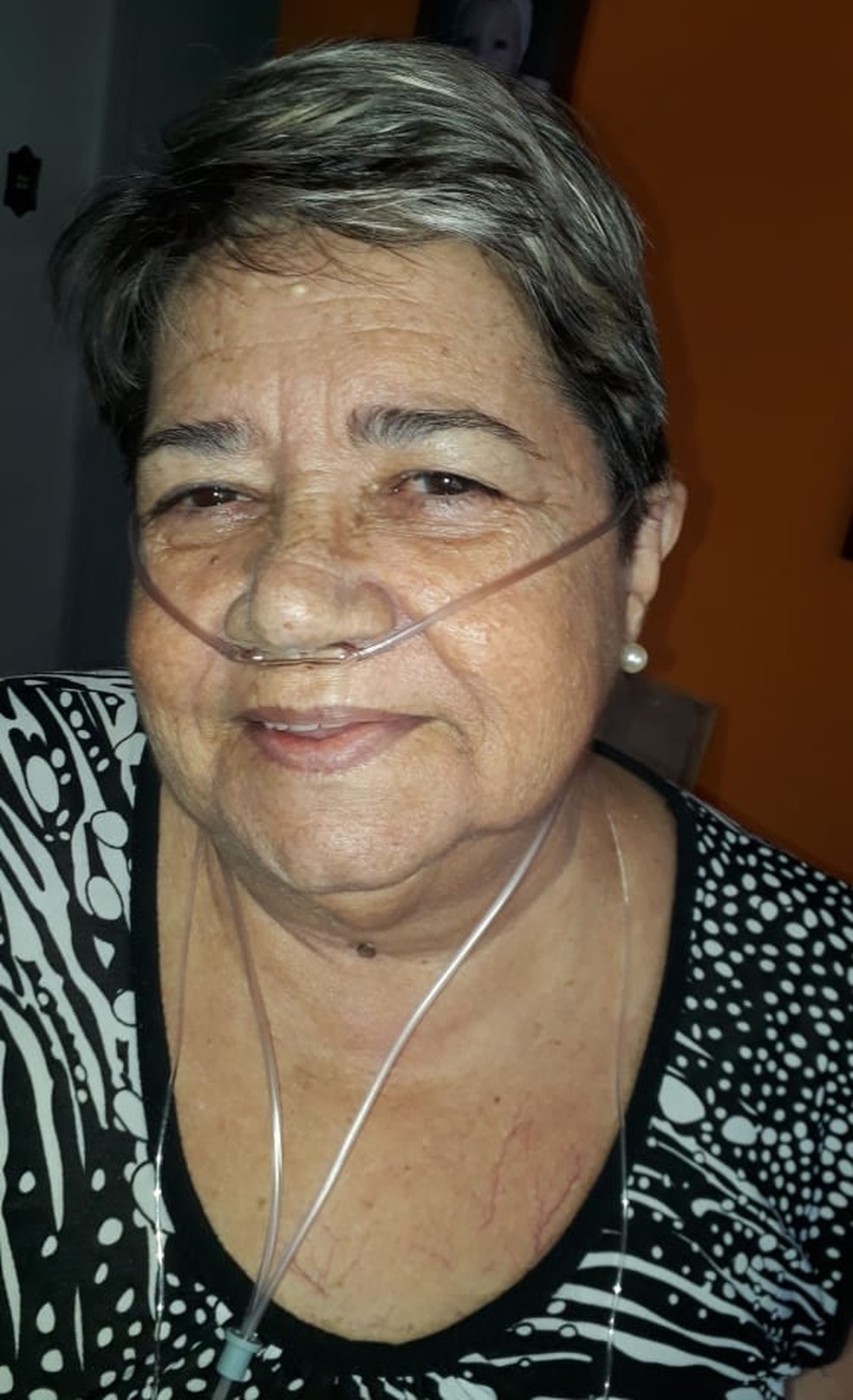 Rosa já precisava de oxigênio por conta da doença pulmonar — Foto: Arquivo Pessoal