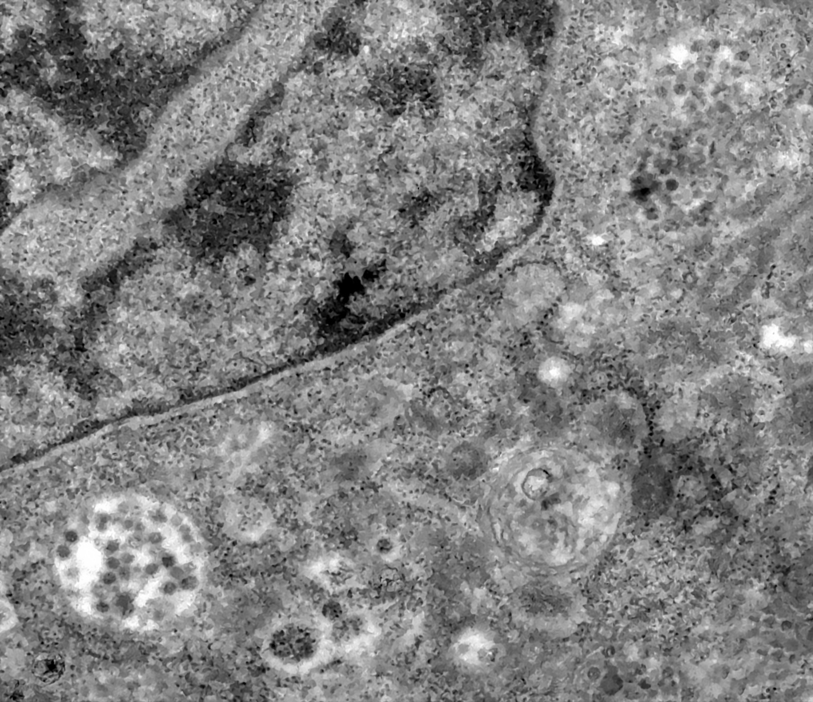 Partículas virais podem ser observadas dentro da célula (Foto: Fiocruz)