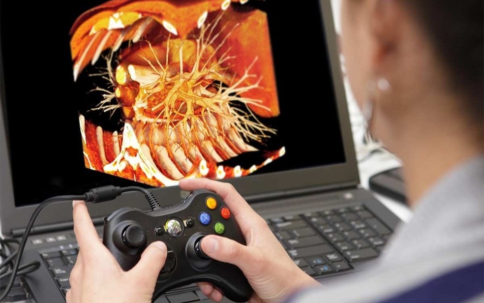 O controle de Xbox 360 é utilizado até nas versões mais recentes do software de estudo anatômico BodyViz — Foto: Divulgação/BodyViz