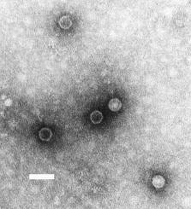 O que se sabe sobre traços de vírus da pólio detectados em Londres (Foto: Wikimedia Commons)
