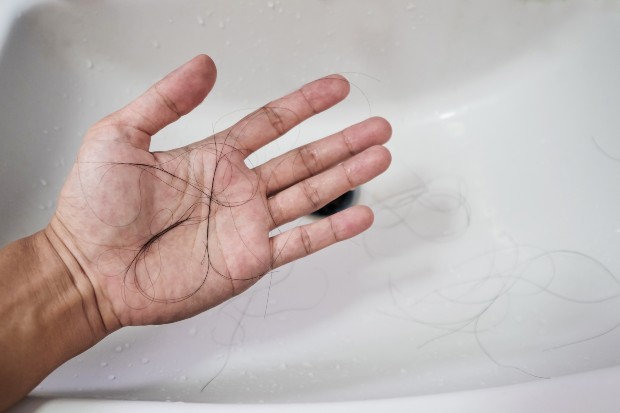 A queda de cabelo é uma das queixas relatadas por pessoas que tiveram Covid-19 (Foto: Getty Images)