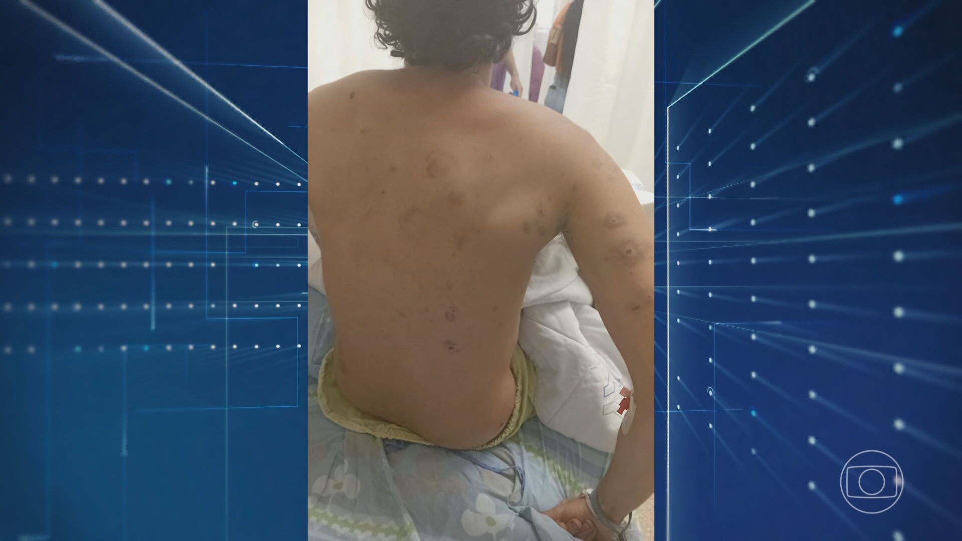 Brasileiro ferido em ataque contra Israel foi atingido por estilhaços de granada