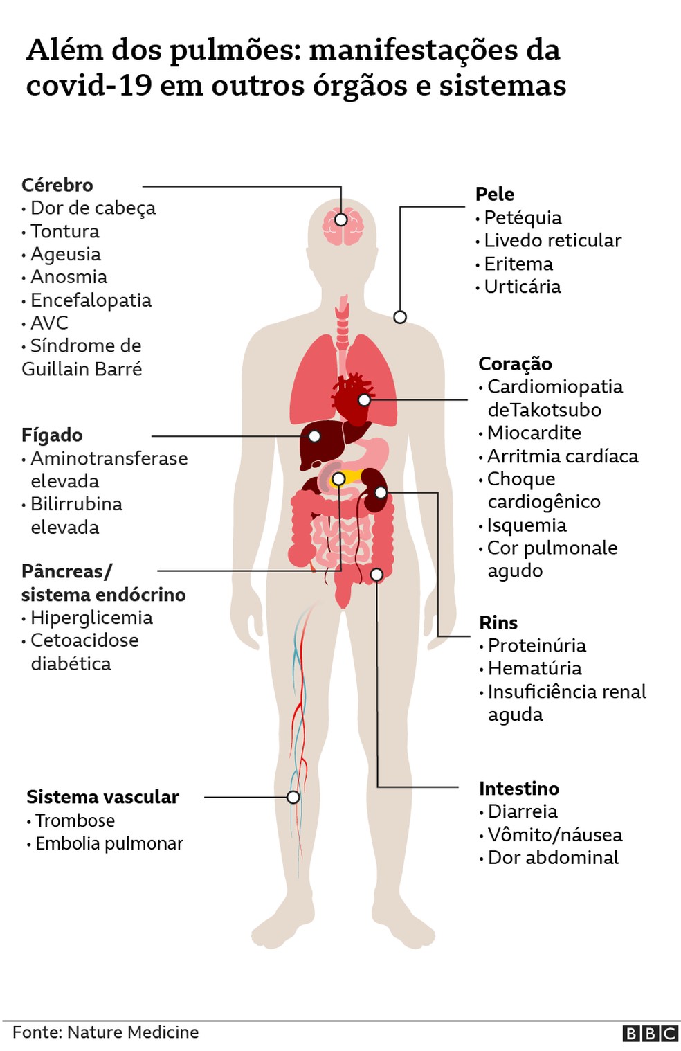 Além dos pulmões, veja manifestação da Covid-19 em outros órgãos e sistemas  — Foto: BBC