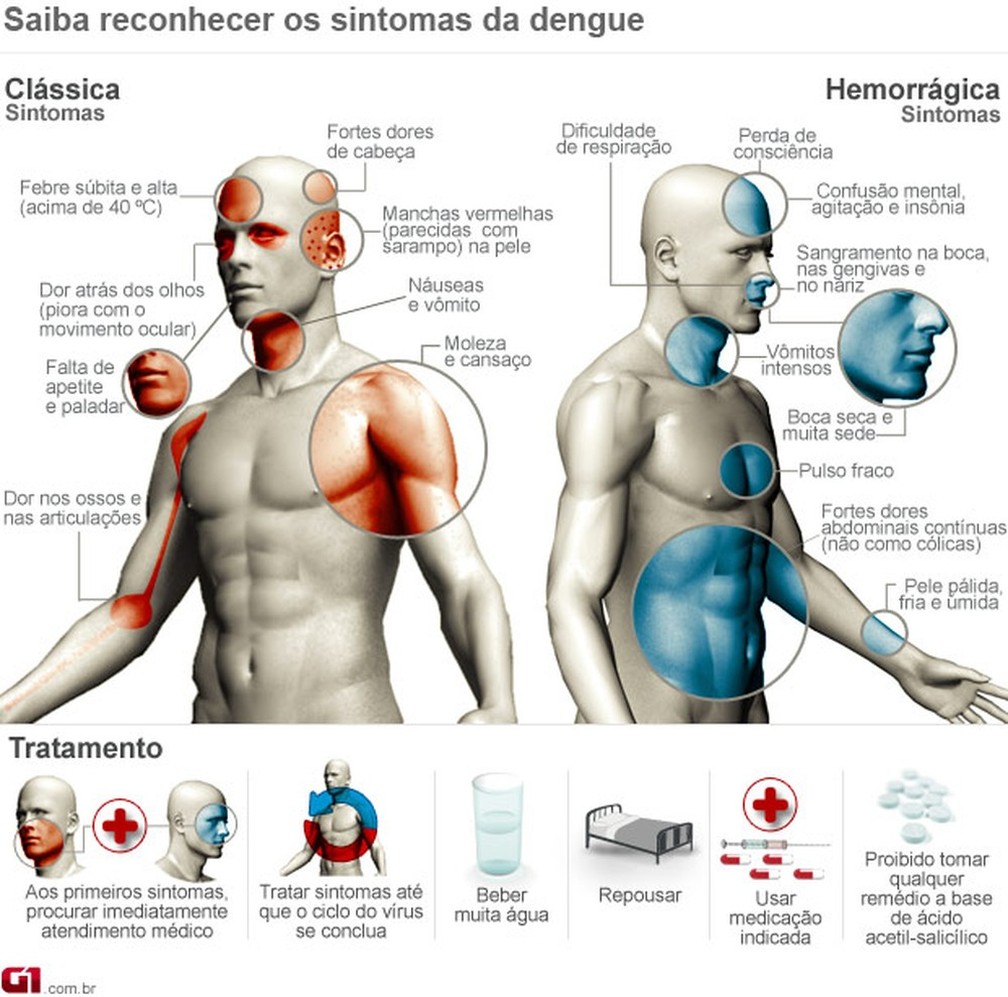 Saiba como reconhecer os sintomas da dengue  — Foto: Arte/G1/Arquivo