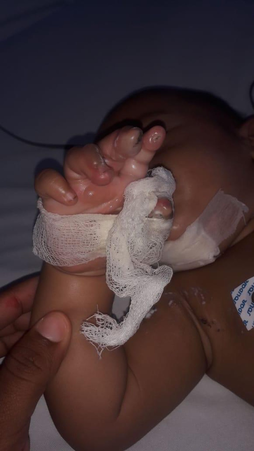 Bebê teria colocado conector de carregador na boca — Foto: Divulgação