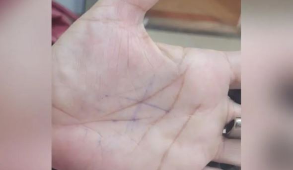 Mulher mostra sinal com 'X' na mão para denunciar ameaças e companheiro é preso em SC