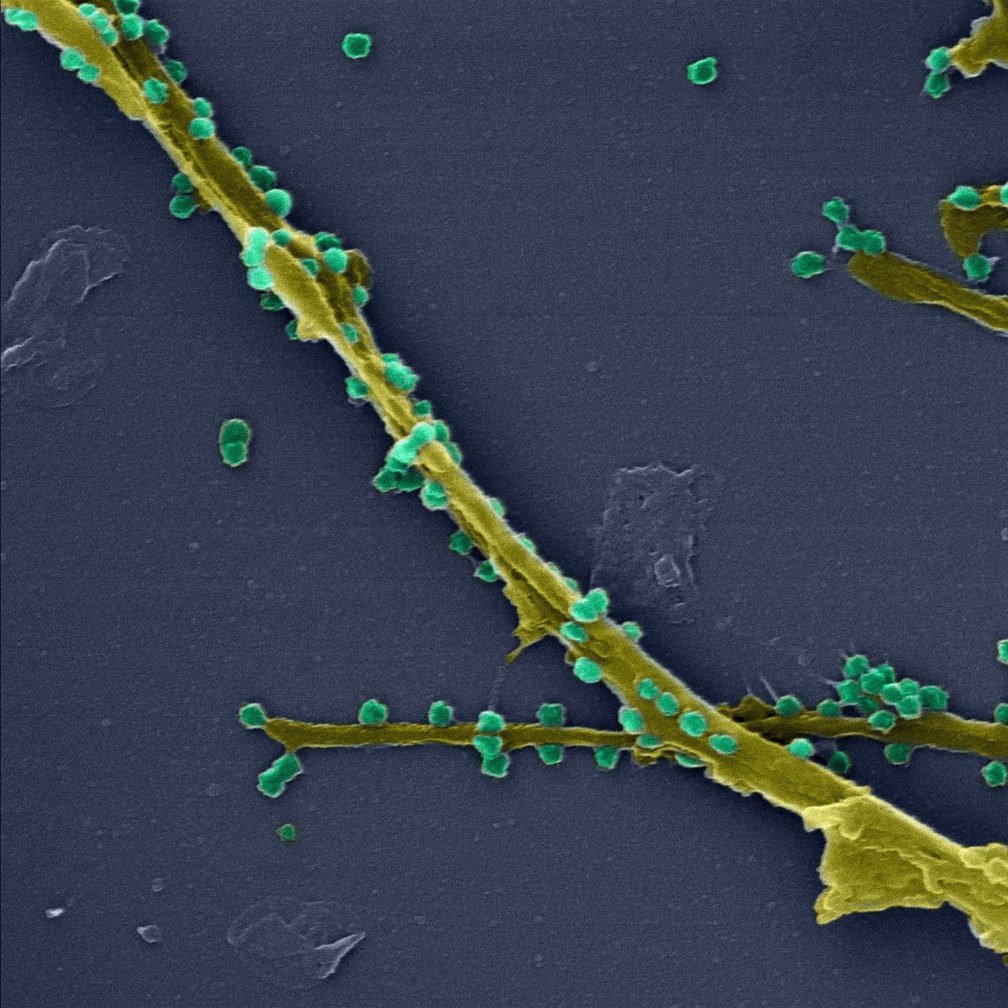Imagem permite ver de perto a conexão entre células e o prolongamentos de membrana, além das partículas virais na superfície — Foto: LMMV/IOC/Fiocruz, LVRS/IOC/Fiocruz e Nulam/Inmetro