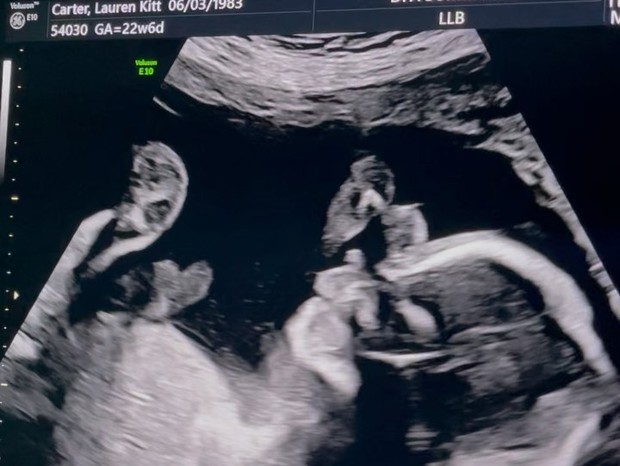 Nick Carter mostra ultrassom de filho (Foto: Reprodução/Instagram)
