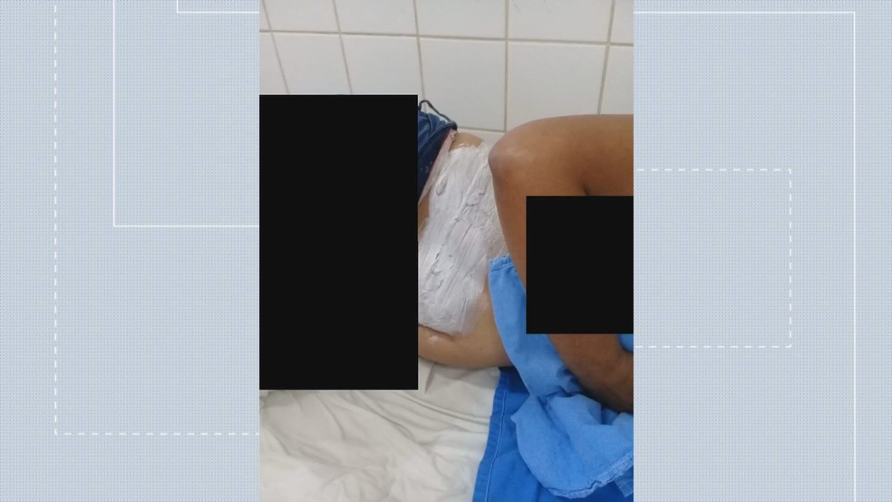Mulher é hospitalizada após ter corpo queimado por companheiro, no DF  — Foto: TV Globo/Reprodução 