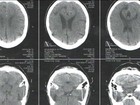 Cientistas de SP criam novo método para detectar transtorno mental