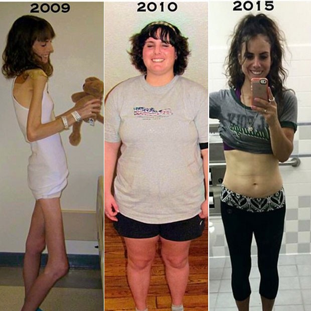 Brittany com 25 kg, com 100 kg e em sua forma atual (Foto: Reprodução/Instagram)