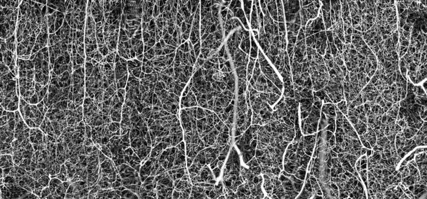Não, esta não é uma estranha floresta congelada de conto de fadas — é o interior do cérebro de um rato! A imagem superdetalhada da rede vascular do córtex somatossensorial de um rato adulto foi tirada por Andrea Tedeschi, da Universidade do Estado de Ohio (Foto: ANDREA TEDESCHI via BBC)