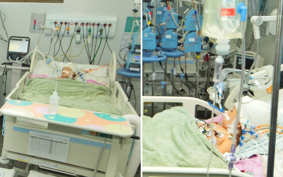 Siamesas Valentina e Heloá internadas em Unidade de Terapia Intensiva (UTI) após cirurgia de separação, em Goiânia, Goiás — Foto: Divulgação/Zacharias Calil