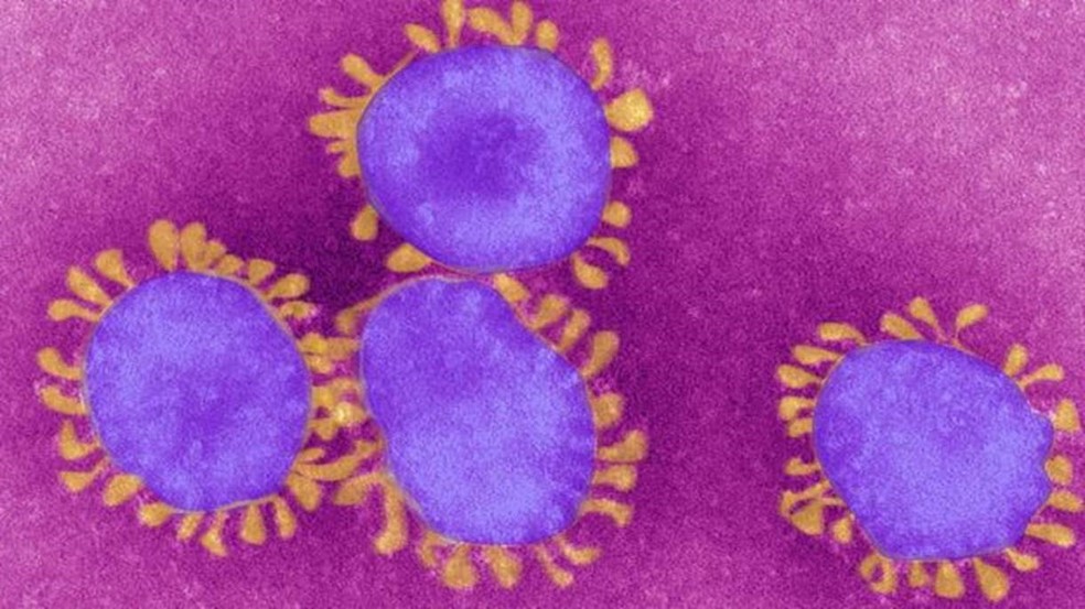 É assim que o coronavírus é visto no microscópio — Foto: Getty Images via BBC