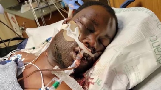 Vídeo da agressão policial que levou Tyre Nichols à morte levanta dúvidas sobre o atendimento da emergência