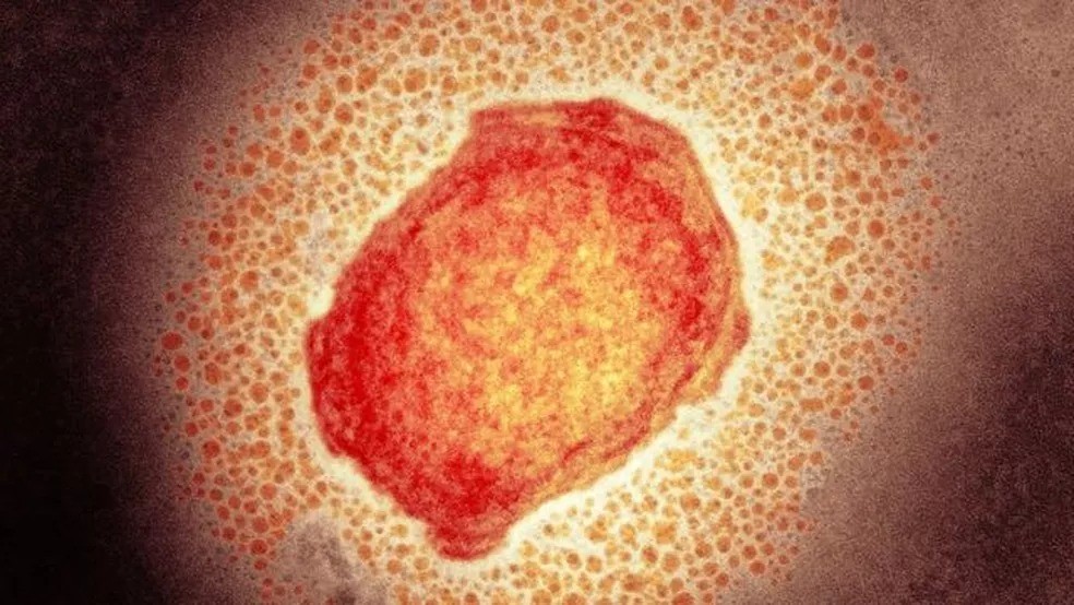 Ceará confirma primeiro caso de varíola dos macacos em criança. — Foto: SCIENCE PHOTO LIBRARY