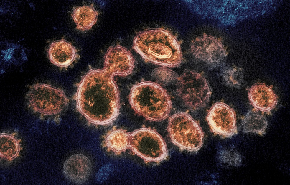 Imagens de microscópio mostram partículas do coronavírus que causam a Covid-19 retiradas de um paciente nos EUA — Foto: NIAID-RML via AP