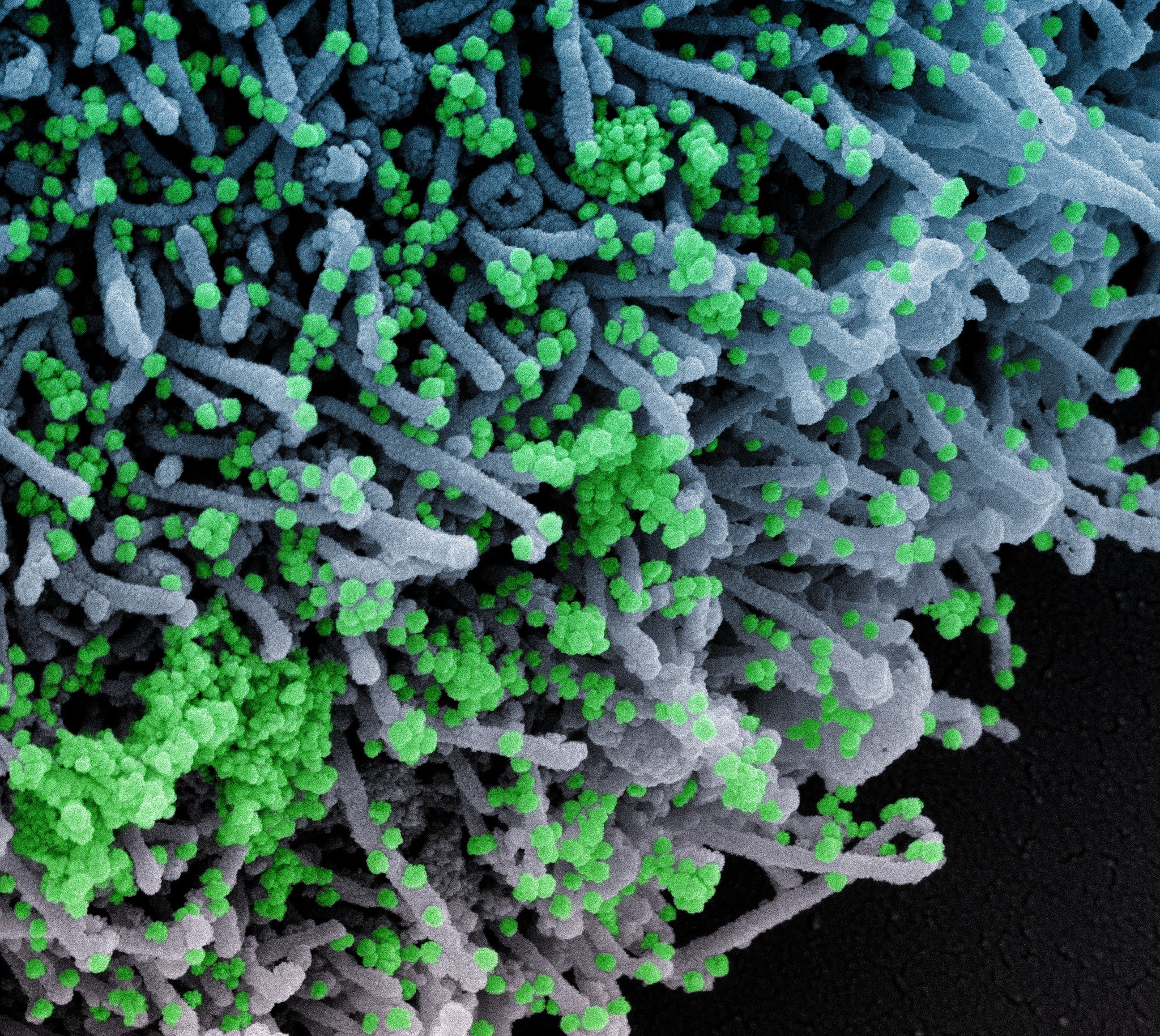 Célula (em azul) infectada por partículas do vírus Sars-CoV-2 (em verde)  (Foto: NIAID)
