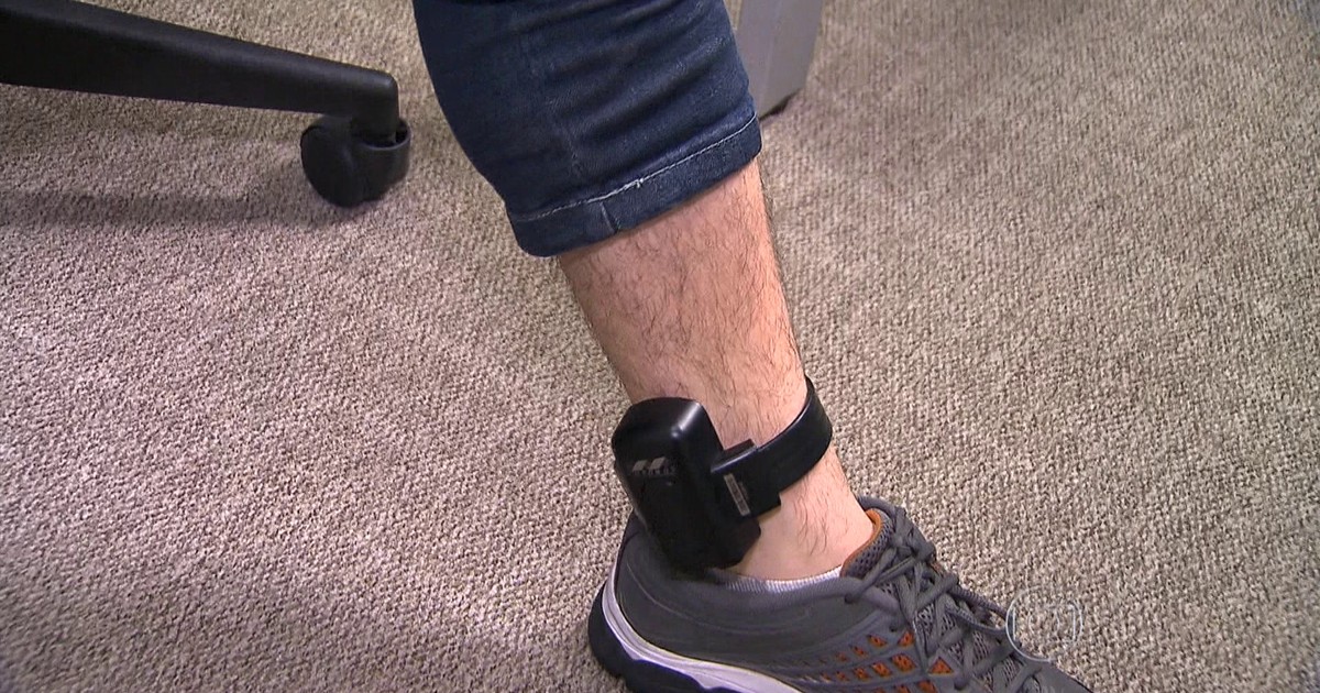 Resultado de imagem para foto de tornozeleira eletronica