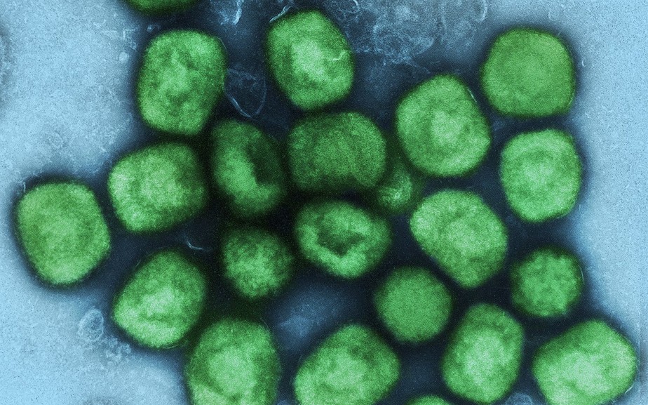 Imagem de microscópio eletrônico colorizada artificialmente mostra vírus da varíola dos macacos (em verde)