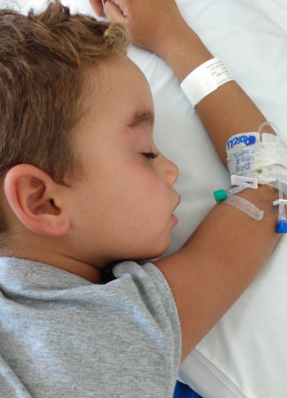 Menino tem crises convulsivas desde a descoberta do tumor &mdash; Foto: Arquivo pessoal