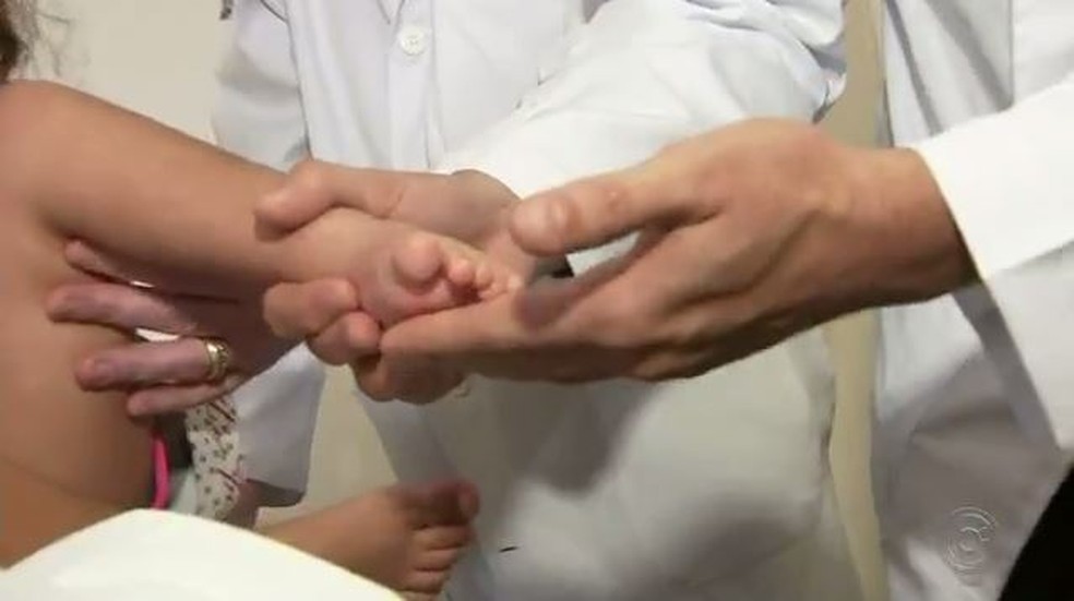 Menina nasceu com mÃ¡ formaÃ§Ã£o congÃªnita no pÃ© esquerdo e precisou passar por cirurgia em Rio Preto (SP) â Foto: ReproduÃ§Ã£o/TV TEM