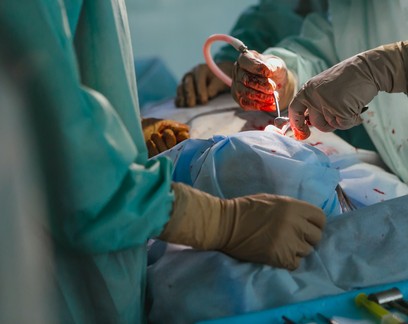 Paciente com morte cerebral recebe transplante de rim de porco nos EUA