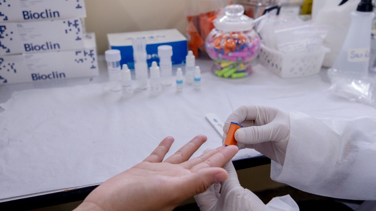 Manaus registra 70 casos de hepatites virais neste ano