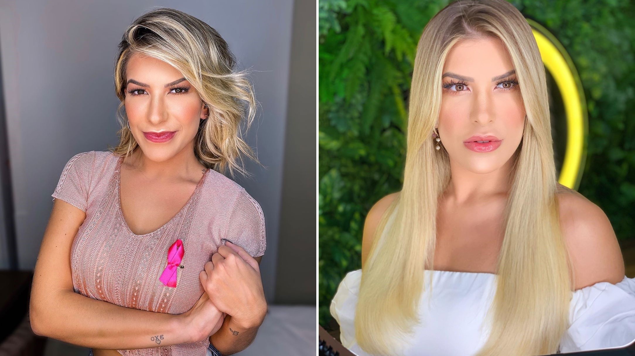 Lorena Improta antes e depois da aplicação (Foto: Reprodução/Instagram)