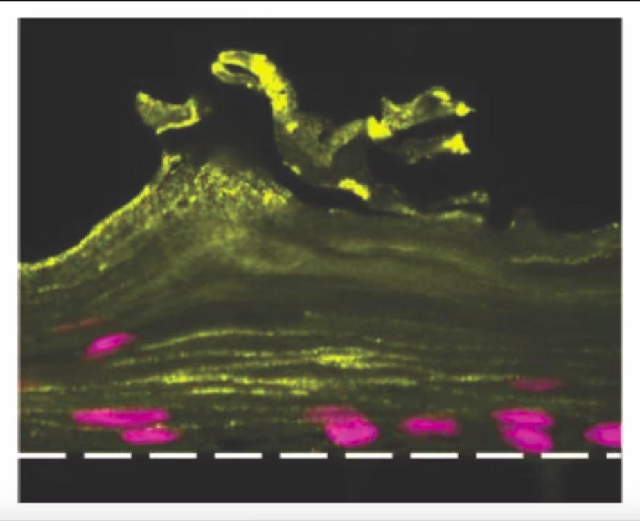 Esta imagem de imunofluorescência mostra que o epitélio vaginal dentro do Vagina Chip desenvolveu camadas distintas e estruturas de tecido (amarelo) que replicam aquelas encontradas na vagina humana.