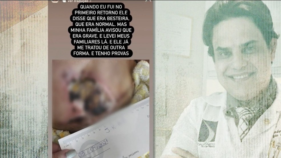 Paciente reclamou das sequelas após um procedimento. — Foto: TV Globo