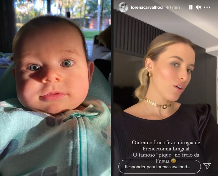 Lorena Carvalho explica sobre cirurgia lingual feita no filho de 4 meses (Foto: Reprodução)