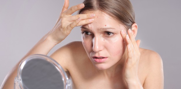 Mulher observa rosto no espelho com acne (Foto: Thinkstock)