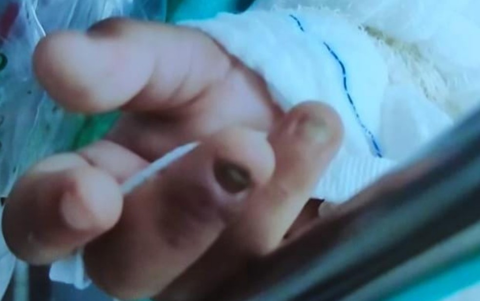 Criança é levada a hospital sem duas unhas e com ferimentos pelo corpo, em Goiânia, Goiás — Foto: Divulgação/Conselho Tutelar